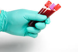 phlebotomy是什么意思