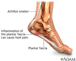 plantar是什么意思