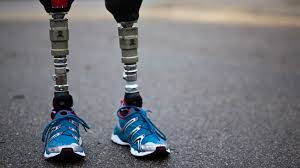 prosthetic是什么意思