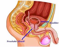 prostrate是什么意思