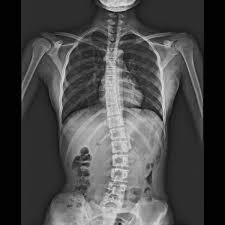 radiography是什么意思