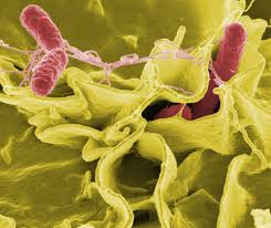 salmonella是什么意思