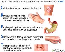 scleroderma是什么意思