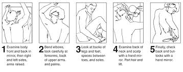 self-examination是什么意思