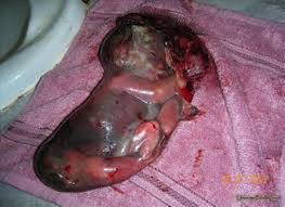stillborn是什么意思