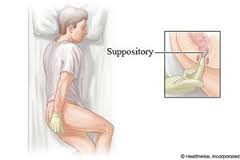 suppository是什么意思