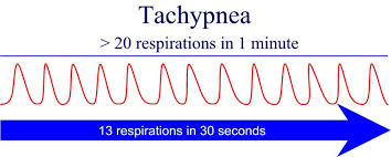 tachypnea是什么意思