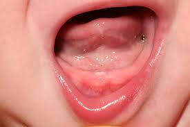 teething是什么意思