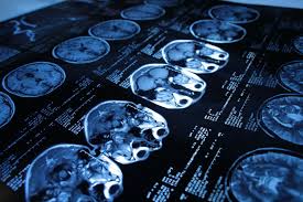 tomography是什么意思