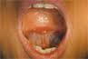 tongueless是什么意思