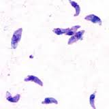 toxoplasmosis是什么意思