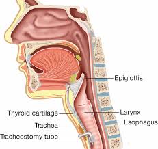 tracheostomy是什么意思