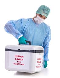 transplant是什么意思