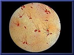 typhoid是什么意思