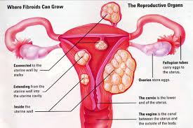 uterine是什么意思